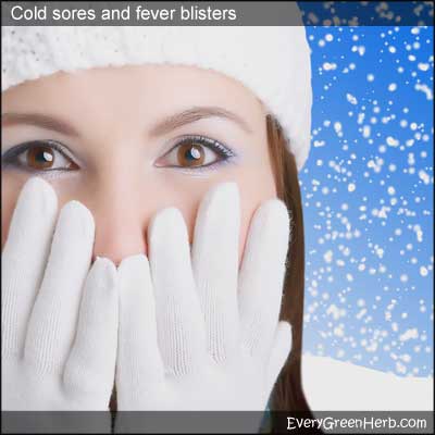 Cold sores and fever blisters most often strike women in the winter months.