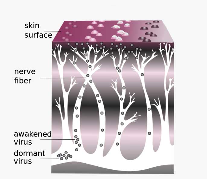 Diagram of herpes, the nerves, and skin