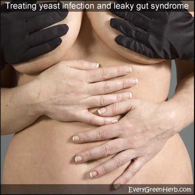 Woman  with yeast infection